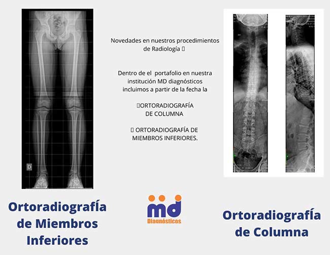 Ortoradiografia